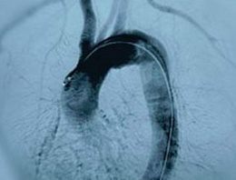 Tıp literatüründe örneği yok!