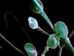 Beslenme sperm sayısını nasıl etkiliyor?